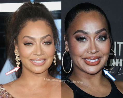 did lala anthony have plastic surgery|Lala Anthony, BEFORE and AFTER 2022 .